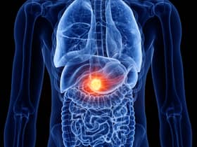 Here are signs of pancreatic cancer you can look out for 