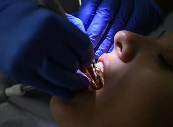 The NHS dental crisis is leading people to perform at-home dentistry, according to an orthodontist 