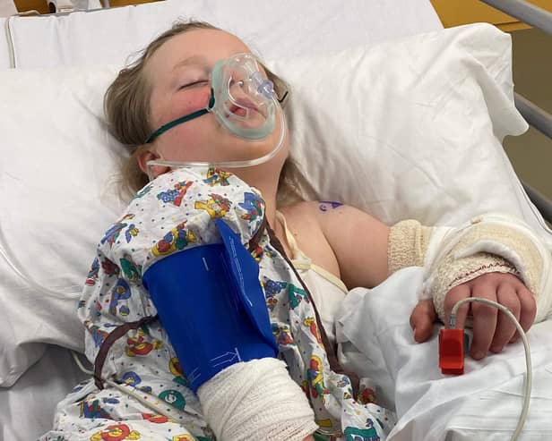 Annabell Rowdon in hospital after being mauled by a dog. 