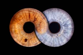 Eyeconic captures the beauty of eyes through high-definition iris imagery