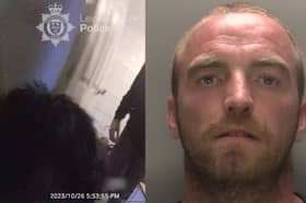 XL bully attacks police officer leaving him needing surgery.