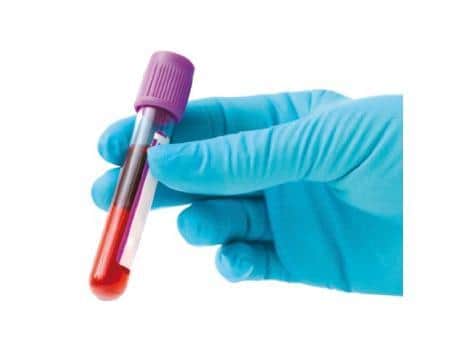 Antibody tests for Covid-19 are being carried out in the Warwick district.