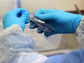 Over 90 per cent of people over the age of 80 have now had at least one dose of a Covid-19 vaccine across Coventry and Warwickshire.