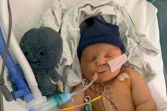 Baby Charlie was born with a heart defect.