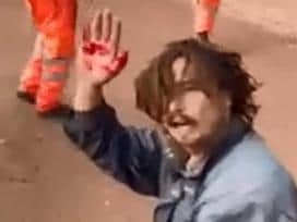 The protester known as 'Badger' shows the blood on his hand.