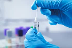 Diagnoses for gonorrhoea and syphilis hit record highs in 2022 in new findings from the UK Health Security Agency.