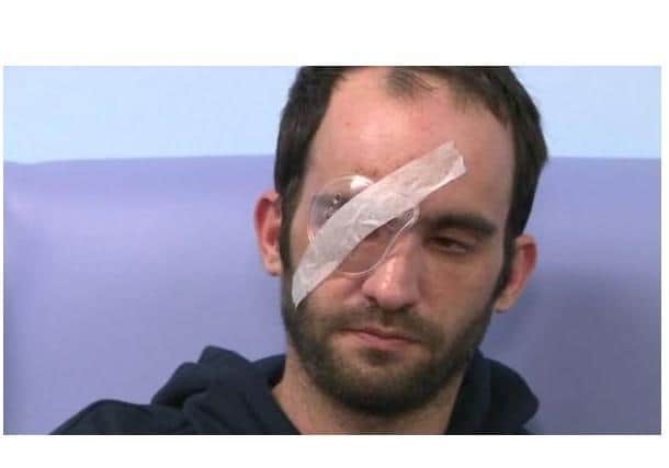 Mark Toone was left blinded in one eye after the attack.