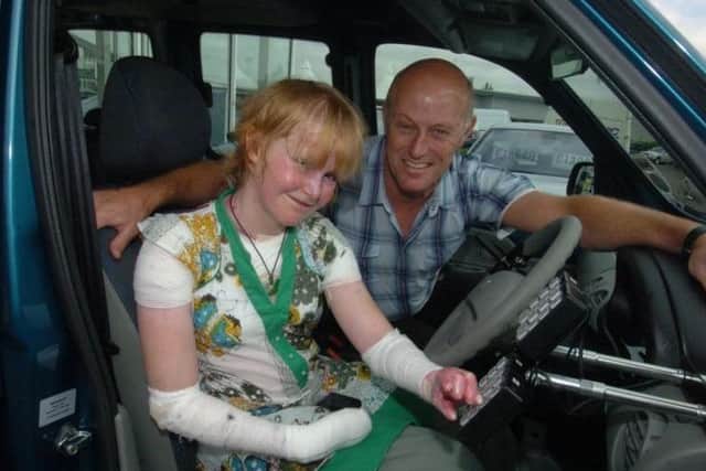 Robin Hood and his daughter Alex who died aged 19 of the rare skin disease dystrophic epidermolysis bullosa (EB).