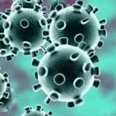 The University of Warwick says it is doing all that it can to help contain the outbreak of Covid cases in Leamington.