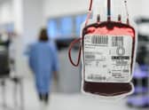 NHS bosses are particularly concerns about a lack of rare blood types