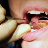 File photo dated 19/05/11 of a dentist at work. People in the UK have been forced to pull out their own teeth at home because they can not access or afford an NHS dentist, a damning new report from the Health and Social Care Committee has found.