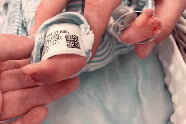 Elis was born prematurely.